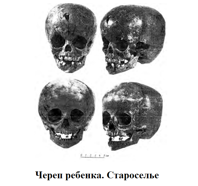 череп старос.png