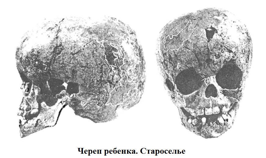 череп.png